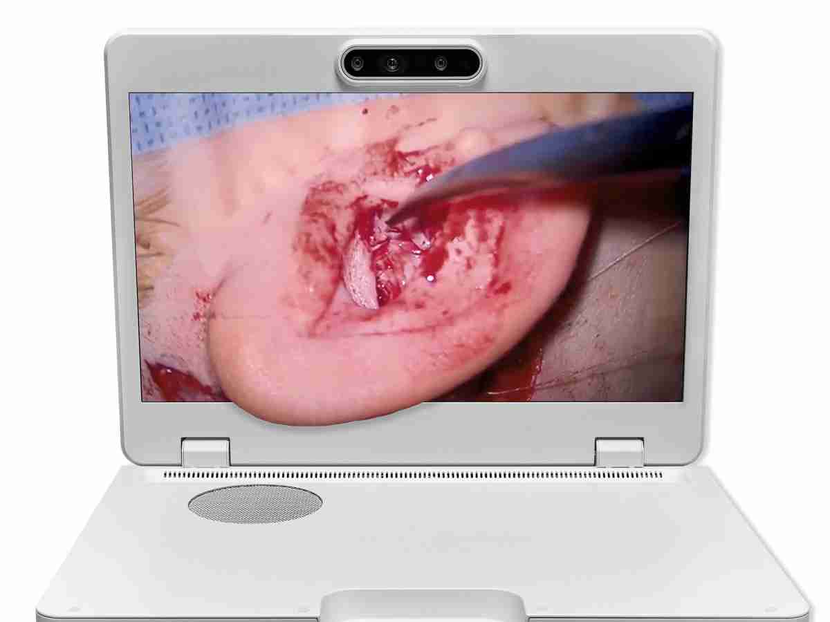 达擎之＂Heads-up 3D显微手术显示系统＂，，整合4K裸眼3D显示及眼球追踪系统，，具备快速追踪人眼移动位置功能，，，，减轻医师长时间维持固定姿势的负担，，，，让医师能有更宽广清晰的3D立体视野及更舒适的姿势来执行手术。。